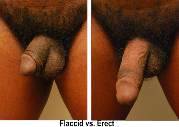 Flaccid vs Erect Naked Caption 600x440